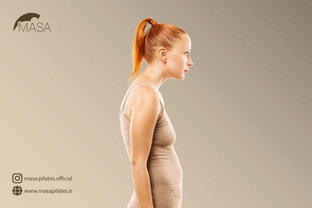 کیفوز یا گوژپشتی